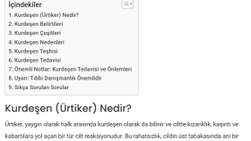 Kurdeşen Belirtileri Hakkında Makale