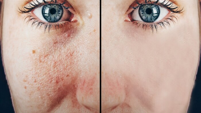 profesyonel olarak yüz temizleme (retouch) yapabilirim