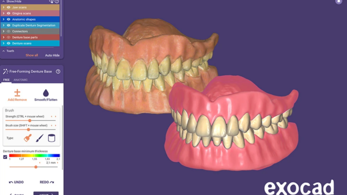 dental sektöründe exocad ile profesyonel tasarım yapıyorum