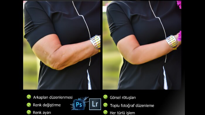 daha ince ve estetik bir görünüm sağlayabilirim