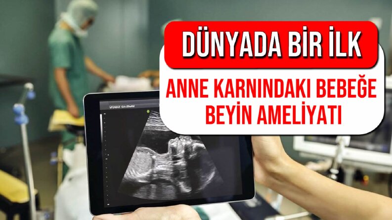 Haber manşet tasarımı