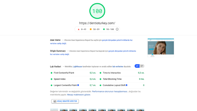 dentioturkey.com Litespeed Optimizasyonu