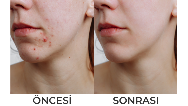 Fotoğraf düzenleme