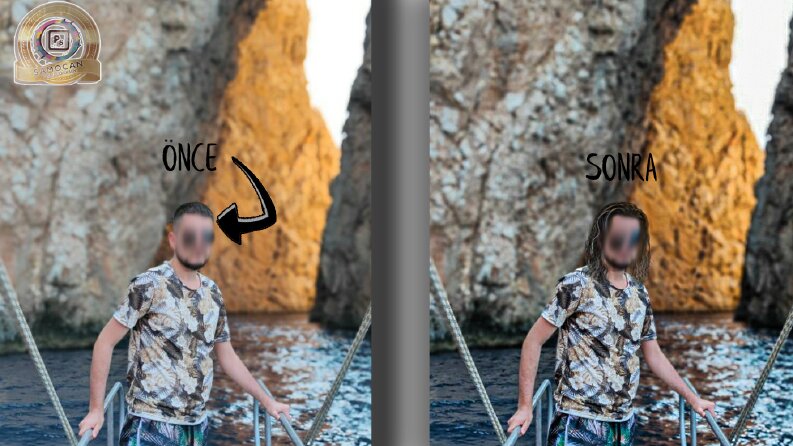 Saç Ekleme