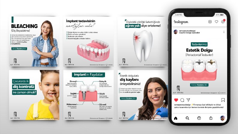 My Dental Sosyal Medya Tasarımları