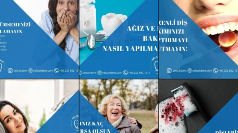 Selçukdent Estetik -Sosyal Medya Yönetimi