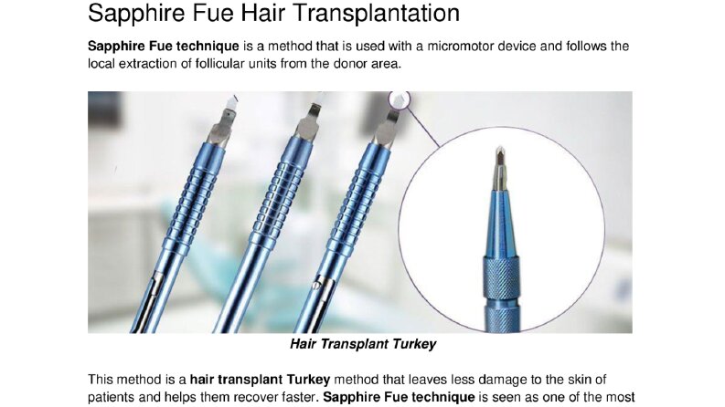 Sapphire Fue Hair Transplantation