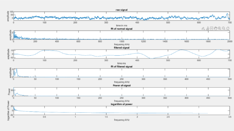 EEG signal processing