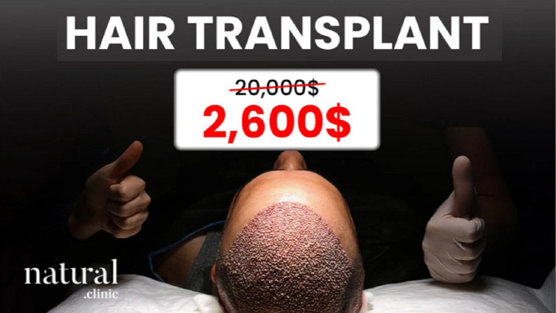 Hair Transplant Meta Add for Natural Clinic