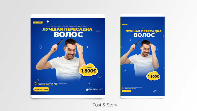 Sosyal Medya Reklam Post & Story