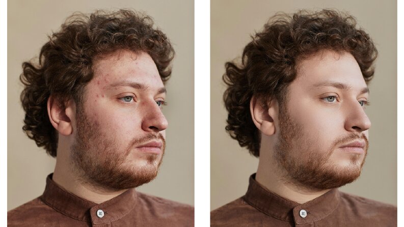 RETOUCH