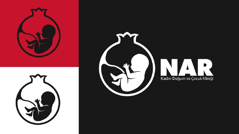 Nar Klinik 2