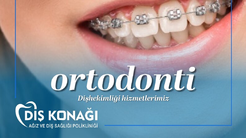 Diş Konağı Sosyal Medya Post Tasarımları