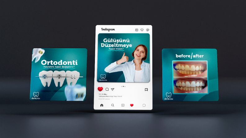 Dentonix Diş Hastanesi - Sosyal Medya İçerik Çalışması
