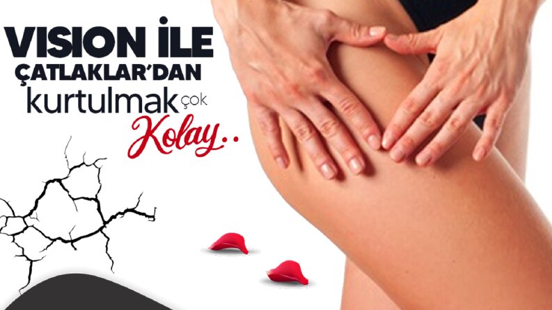 Post Tasarımı