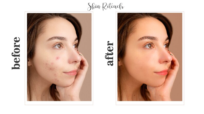 Retouch 