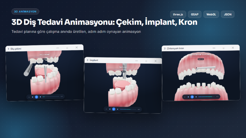 Plandan Üretilen 3D Diş Tedavi Animasyonu