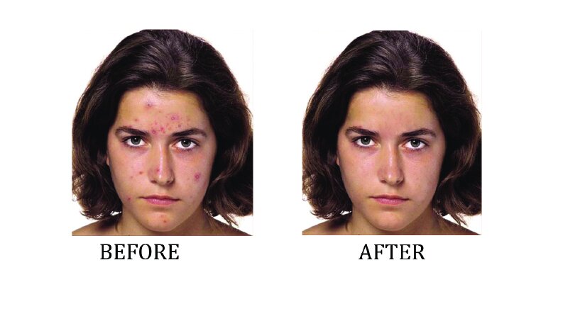 yüz temizleme