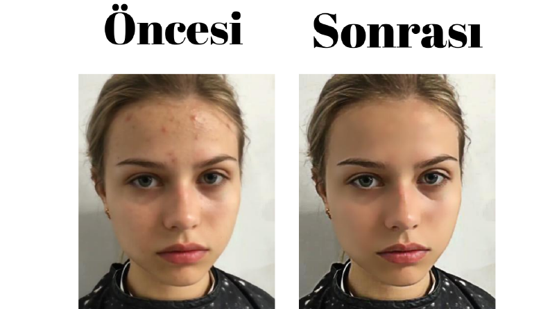 Yüz Retouch