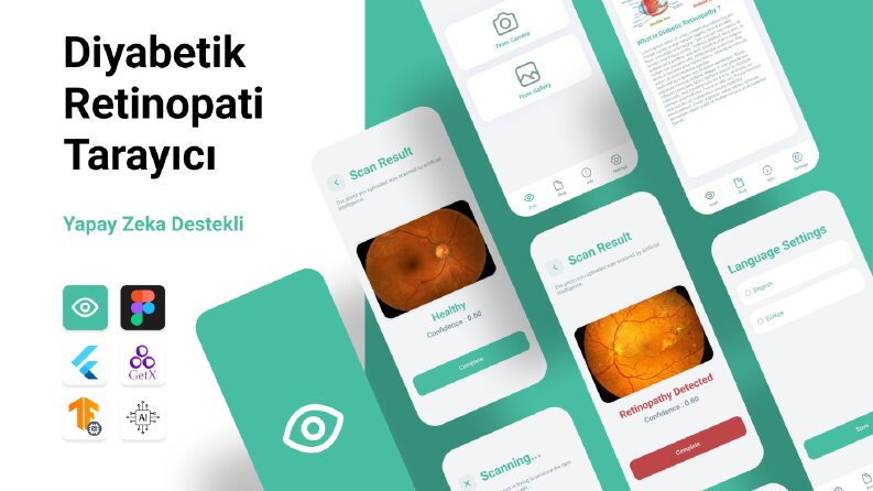 Yapay Zeka Destekli Retina Tarayıcı