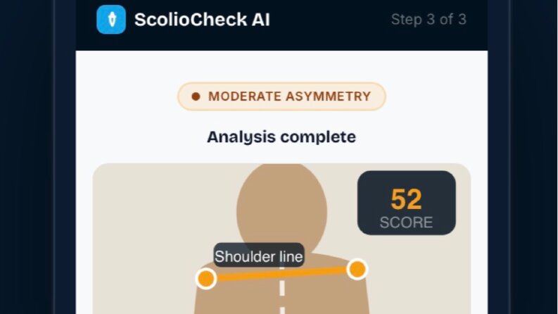 ScolioCheck AI Landing Page ve Website Prototipi