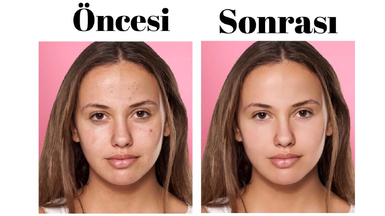 Yüz Retouch