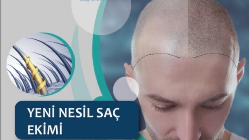 banner tasarımı